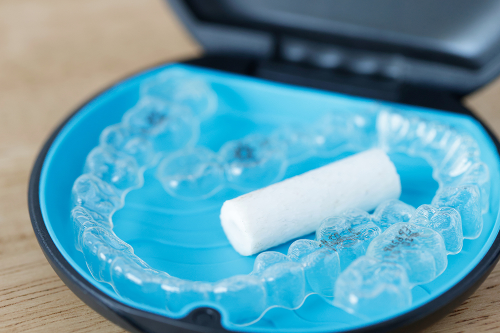 マウスピース矯正とは